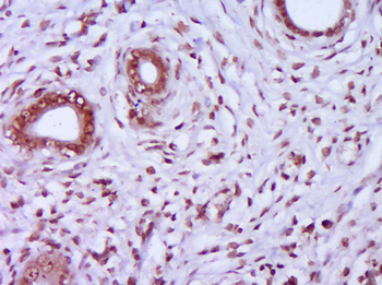 HSP27 Rabbit Polyclonal Antibody