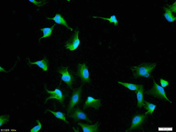 HSP70 Rabbit Polyclonal Antibody