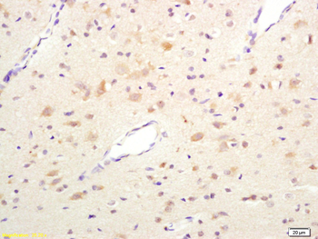 HSP105 Rabbit Polyclonal Antibody