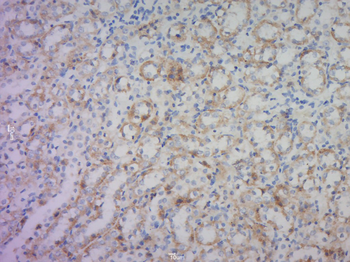 HTRA2 Rabbit Polyclonal Antibody