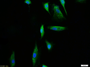 TERT Rabbit Polyclonal Antibody