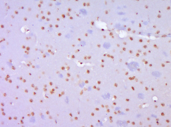 TERT Rabbit Polyclonal Antibody