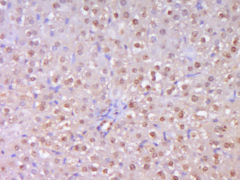 TERT Rabbit Polyclonal Antibody