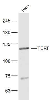 TERT Rabbit Polyclonal Antibody