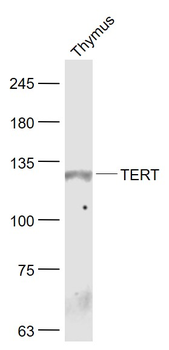 TERT Rabbit Polyclonal Antibody