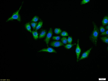 IASPP Rabbit Polyclonal Antibody