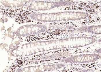 AIF1/Iba1 Rabbit Polyclonal Antibody