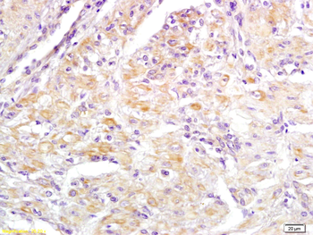 DFFA Rabbit Polyclonal Antibody