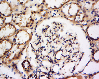 DFFA Rabbit Polyclonal Antibody