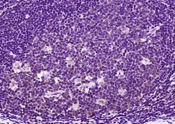 IFI16 Rabbit Polyclonal Antibody