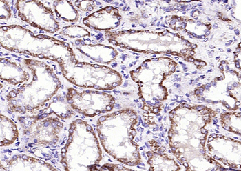 IFNB1 Rabbit Polyclonal Antibody