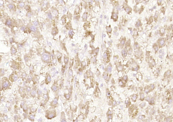 IFNB1 Rabbit Polyclonal Antibody