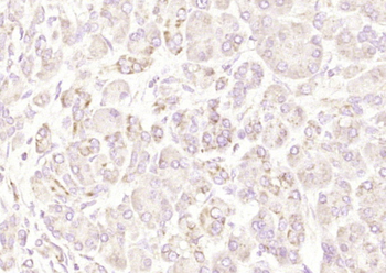 IFNB1 Rabbit Polyclonal Antibody
