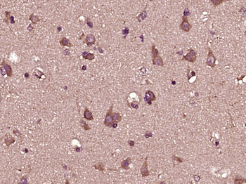 IFNA13 Rabbit Polyclonal Antibody