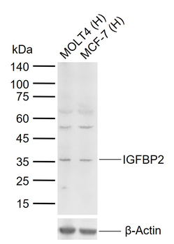 IGFBP2 Rabbit Polyclonal Antibody