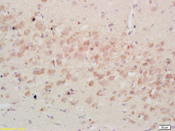 IGFBP3 Rabbit Polyclonal Antibody