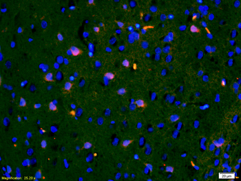 IGFBP3 Rabbit Polyclonal Antibody
