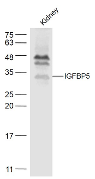 IGFBP5 Rabbit Polyclonal Antibody