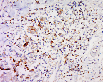IGFBP5 Rabbit Polyclonal Antibody