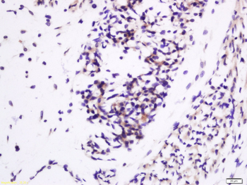 IGF2 Rabbit Polyclonal Antibody