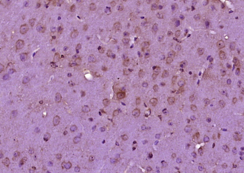 IGF2BP3 Rabbit Polyclonal Antibody