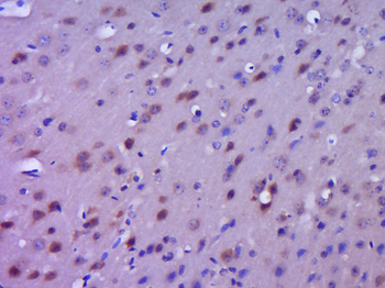 IKB alpha Rabbit Polyclonal Antibody