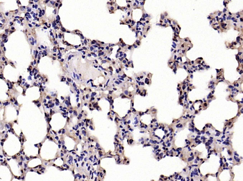 IKB alpha Rabbit Polyclonal Antibody