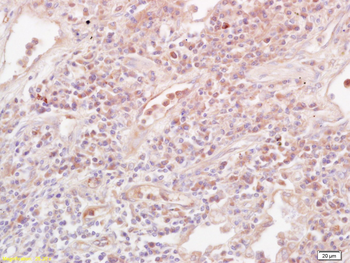 IL-10 Rabbit Polyclonal Antibody