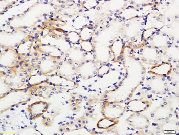 IL-10 Rabbit Polyclonal Antibody