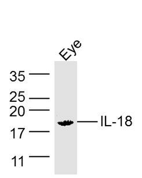 IL18 Rabbit Polyclonal Antibody