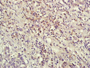 IL-1 Beta Rabbit Polyclonal Antibody