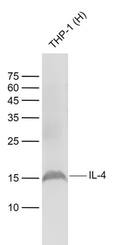 IL-4 Rabbit Polyclonal Antibody