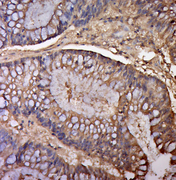 IL-5 Rabbit Polyclonal Antibody