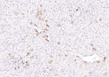 IL-5 Rabbit Polyclonal Antibody