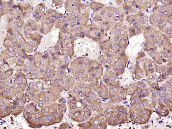 IL6ST/CD130 Rabbit Polyclonal Antibody