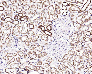 IL-8/CXCL8 Rabbit Polyclonal Antibody