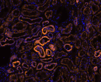 IL-8/CXCL8 Rabbit Polyclonal Antibody