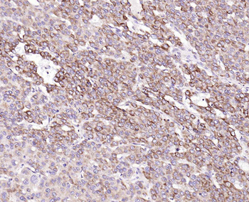 IL-8/CXCL8 Rabbit Polyclonal Antibody