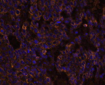 IL-8/CXCL8 Rabbit Polyclonal Antibody
