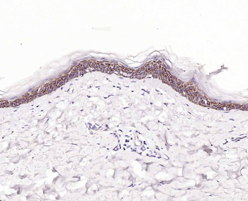 IL-8/CXCL8 Rabbit Polyclonal Antibody