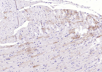 ILK-1 Rabbit Polyclonal Antibody