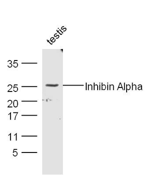 Inhibin Alpha Rabbit Polyclonal Antibody