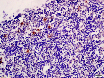 Inhibin Alpha Rabbit Polyclonal Antibody
