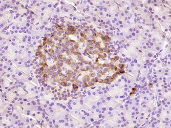 Proinsulin Rabbit Polyclonal Antibody