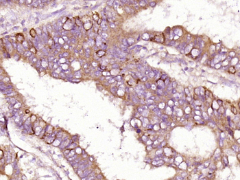 Insulin Receptor alpha Rabbit Polyclonal Antibody