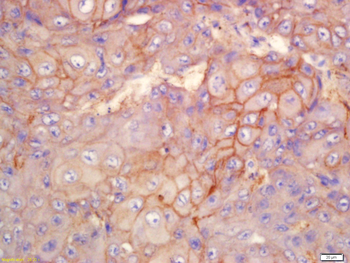 Integrin Alpha V Rabbit Polyclonal Antibody