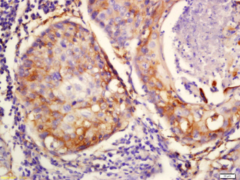 Integrin Alpha V Rabbit Polyclonal Antibody