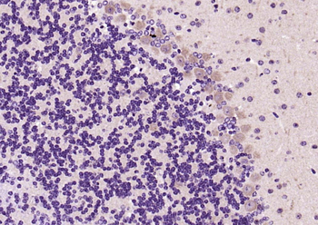 IRS1 Rabbit Polyclonal Antibody