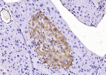 IRS-2 Rabbit Polyclonal Antibody