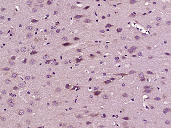 IRS3 Rabbit Polyclonal Antibody